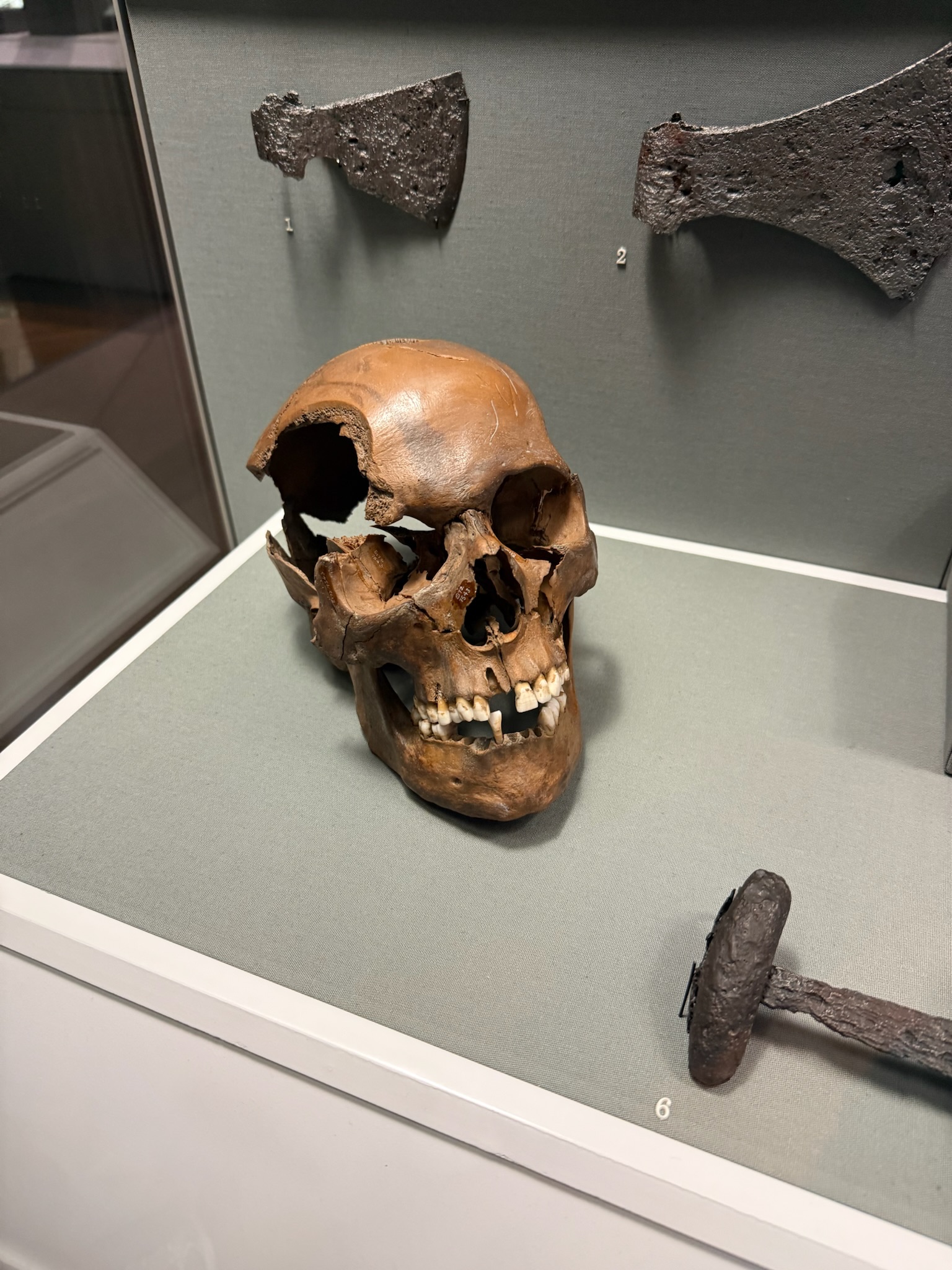 A cracked skull on display with viking swords behind it